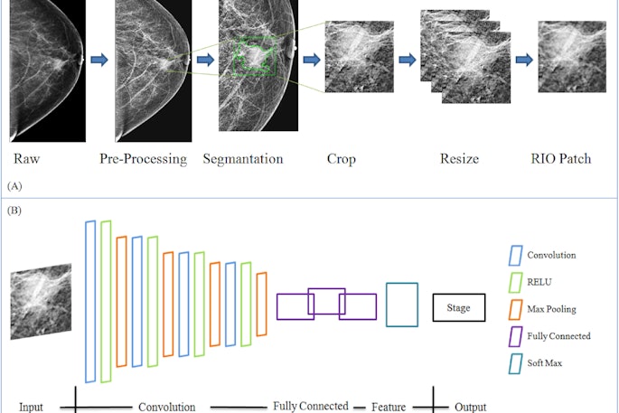 Researchers explain the data preparation and structure of a proposed CNN-based deep learning model using mammography features to determine breast tumor staging. The image is available for use under a Creative Commons license: CC BY-NC-ND 4.0 DEED Attribution-NonCommercial-NoDerivs 4.0 International.