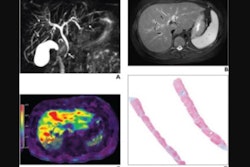 2024 04 19 7 Year Old Boy With Autoimmune Sclerosing Cholangitis