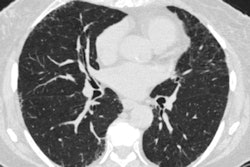 2024 04 30 Radiology Choi Figure2 Thumbnail