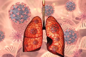 3 D Lungs Covid Virus Cells