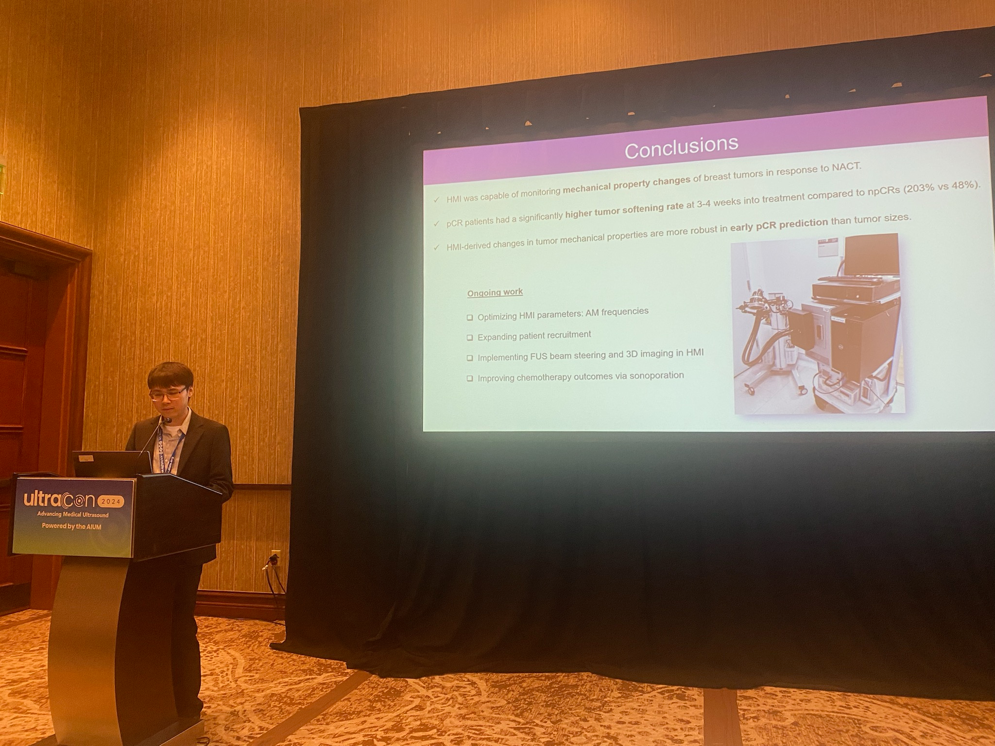 Yangpei Liu from Columbia University in Ney York City discussed findings at UltraCon suggesting that harmonic motion imaging could be a viable predictor of early treatment response.