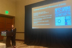 Corinne Wessner from Thomas Jefferson University discusses early study results at UltraCon showing the potential of ultrasound-triggered microbubble destruction in treating liver disease.