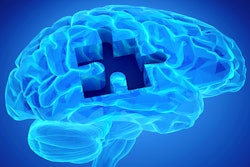 Brain Puzzle Dementia Social