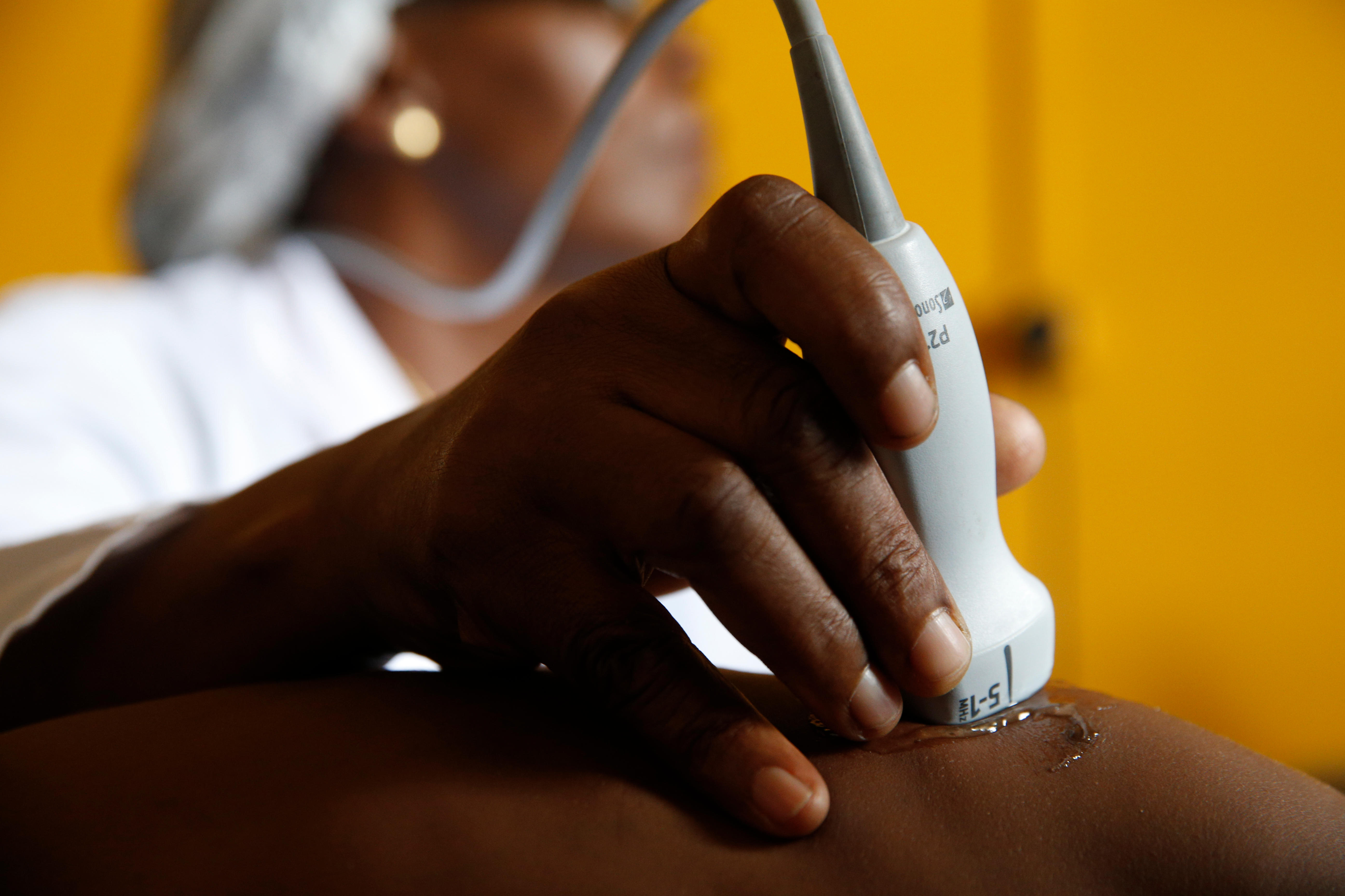 Ultrasound In Africa