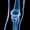 X Ray Knee 400