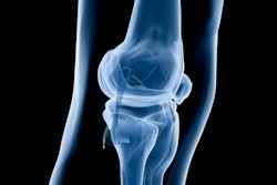 X Ray Knee 400