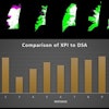 Dice similarity index measurements compare the x-ray pulsatility index (XPI) to digital subtraction angiography in patients with suspected chronic thromboembolic pulmonary hypertension. XPI is green, pulmonary angiography is pink and the overlap between the two is white. Image courtesy of the ARRS.