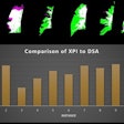 Dice similarity index measurements compare the x-ray pulsatility index (XPI) to digital subtraction angiography in patients with suspected chronic thromboembolic pulmonary hypertension. XPI is green, pulmonary angiography is pink and the overlap between the two is white. Image courtesy of the ARRS.