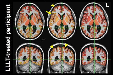 2024 05 28 Radiology Chan Image Thumb