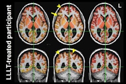 2024 05 28 Radiology Chan Image Thumb