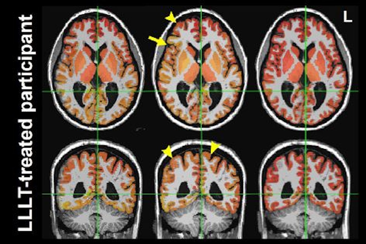 メタボリックサージェリーClinical Update メタボリックサージェリーClinical Update メタボリックサー
