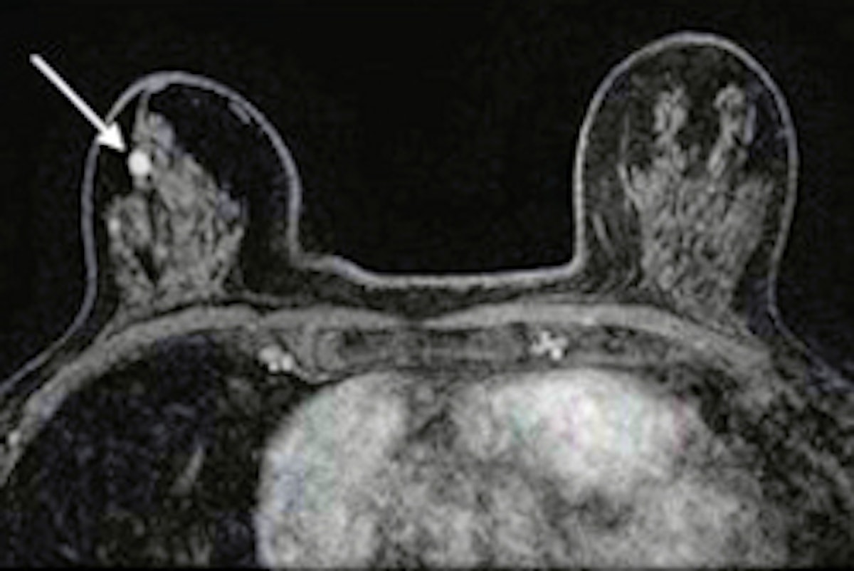 Abbreviated MRI suitable in subsequent screening of dense breasts