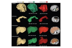 This image shows ground-truth manual organ segmentations (yellow) vs. DynUNet-TL (green) and TotalSegmentator (red) predictions. Photo courtesy of the American Journal of Roentgenology.