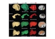 This image shows ground-truth manual organ segmentations (yellow) vs. DynUNet-TL (green) and TotalSegmentator (red) predictions. Photo courtesy of the American Journal of Roentgenology.