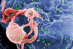 Hiv 1 Virions Cdc