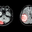 Mri Brain Disease Montage Thumb