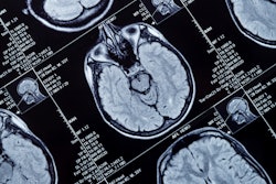 Mri Brain Head