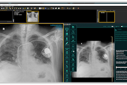 Sampling of Carpl.ai's in-PACS monitoring. Photo courtesy of Carpl.ai.