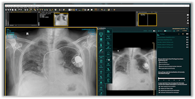 Sampling of Carpl.ai's in-PACS monitoring. Photo courtesy of Carpl.ai.