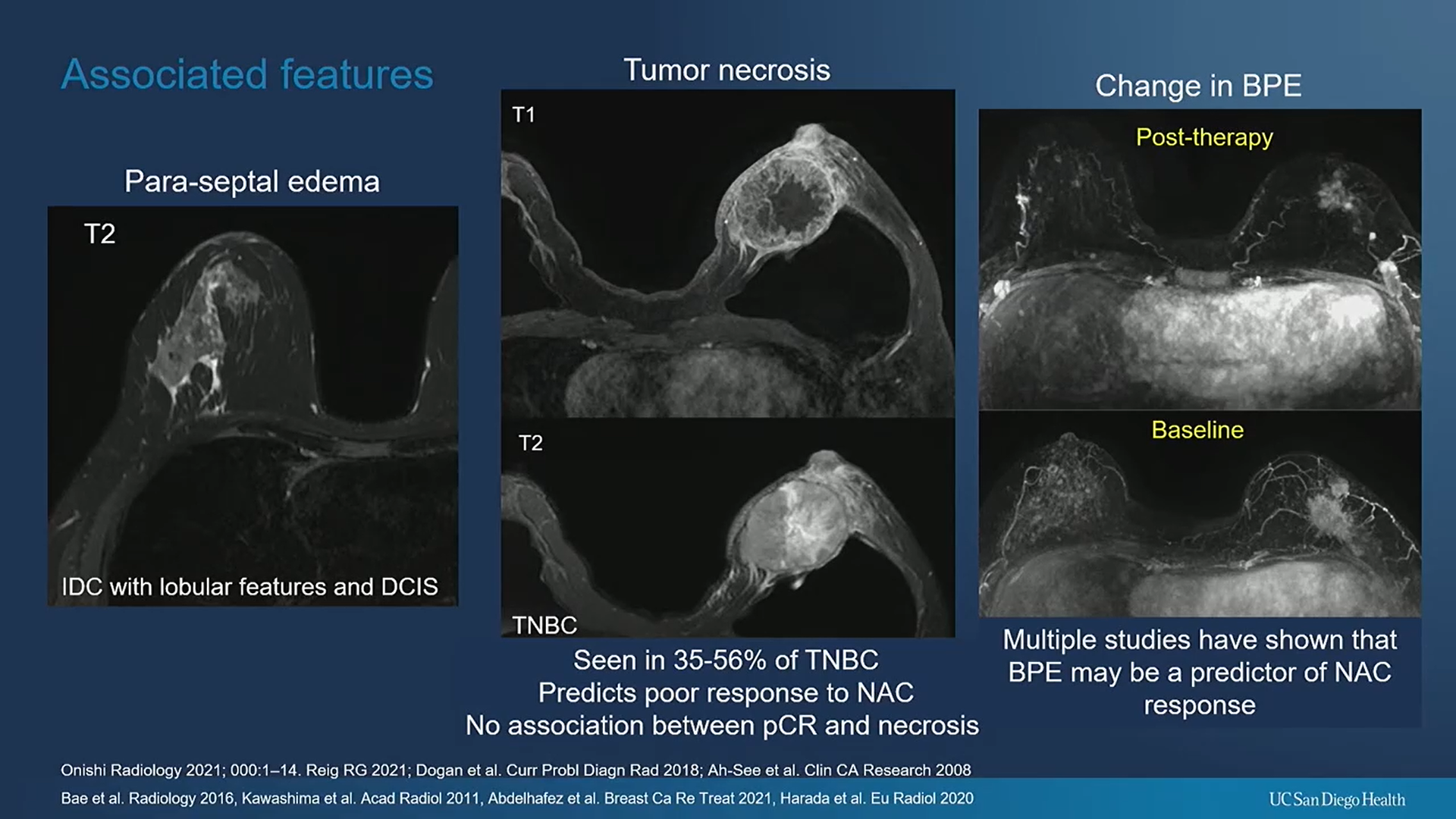 Research presented at the ARRS annual meeting highlighted the need for more detailed breast MRI reporting for neoadjuvant chemotherapy responses. One finding highlighted was that BPE changes are underreported.