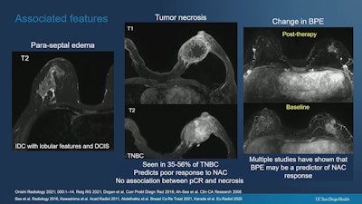 Research presented at the ARRS annual meeting highlighted the need for more detailed breast MRI reporting for neoadjuvant chemotherapy responses. One finding highlighted was that BPE changes are underreported.
