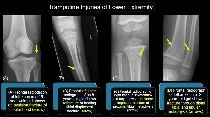 Image courtesy of the ARRS.