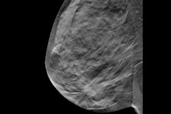 Breast Dbt Social