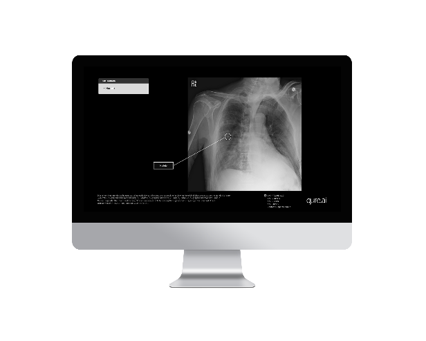 Qure.ai will unveil its lung care continuum at the ASCO annual meeting.