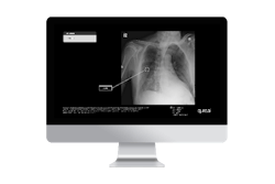 Qure.ai will unveil its lung care continuum at the ASCO annual meeting.