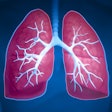 Lung General 400