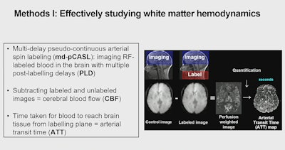 Young Investigator Award finalist Nikou Louise Damestani, PhD, explained a study of white matter hemodynamics. The work raises questions about white matter hemodynamics as a potential biomarker preceding structural decline and cognitive change in the brain.