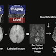 Studying White Matter Hemodynamics Ismrm2024