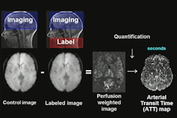 Studying White Matter Hemodynamics Ismrm2024