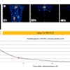 Lesion uptake from a patient with a solitary fibrous tumor and its FAP expression on gallium-68 (GA-68)-FAPI-46 (A) and intratherpeutic Y-90-FAPI-46 (B). The panel shows the constructed time activity curve with the three PET/CT measurements.