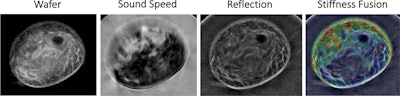 Images from the automated breast ultrasound tomography system (SoftVue, Delphinus Medical Technologies) show four coronal volumetric image-stack sequences: wafer (waveform-enhanced reflection, which enhances fat so that dark masses are better visualized), sound speed (a direct output of image acquisition showing the change in the speed of sound moving through breast tissue), reflection (equivalent to B mode), and stiffness fusion (transmission properties of sound speed and attenuation overlaid on coregistered reflection images to highlight relative differences in tissue stiffness). A single slice from each sequence is shown.
