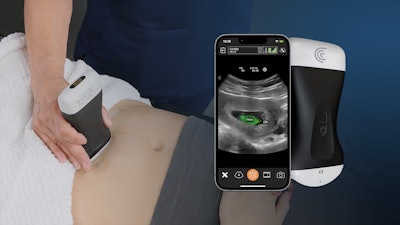 Clarius OB AI automatically highlights key fetal anatomy.