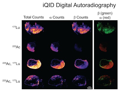 Autoradiography images of GPA33(+) SW1222 xenograft sections acquired using an ionizing-radiation quantum imaging detector (iQID) camera. The images effectively illustrate that the DOTA-PRIT (DOTA pretargeted radioimmunotherapy) approach can be used to simultaneously deliver Ac-225 and Lu-177 to tumors. Mice were injected with Lu-177 or Ac-225 radioligand alone (first and second row, respectively), or a Lu-177/Ac-225 mixture (row 3 and 4), after pretargeting with anti-GPA33/anti-DOTA bispecific antibody. First column shows the combined signal (Lu-177 and Ac-225 together), second column (⍺-counts) shows uptake of Ac-225, and third column (β-counts) show Lu-177uptake. Fourth column shows an overlay of the Ac-225 signal (red) and Lu-177 signal (green). Image and caption courtesy of SNMMI.