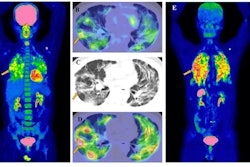 Fdg Fapi Imaging Positive Snmmi 2024