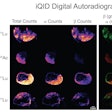 An autoradiography image showing the simultaneous biodistribution of Lutetium-177 and Actinium-225 radionuclides in colon cancer xenografts in mice.