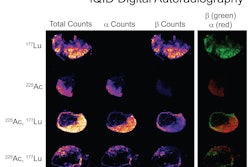 An autoradiography image showing the simultaneous biodistribution of Lutetium-177 and Actinium-225 radionuclides in colon cancer xenografts in mice.
