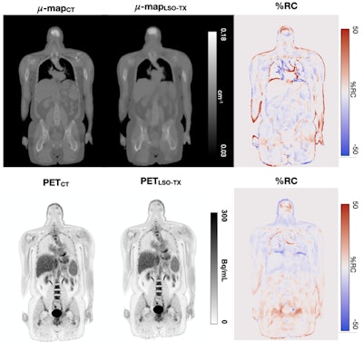 Top row: CT- and LSO-TX-based attenuation maps with their respective percentage relative change (%RC) map. Bottom row: PET images reconstructed using CT- and LSO-TX-based attenuation maps with their respective %RC map. Image and caption courtesy of the SNMMI.