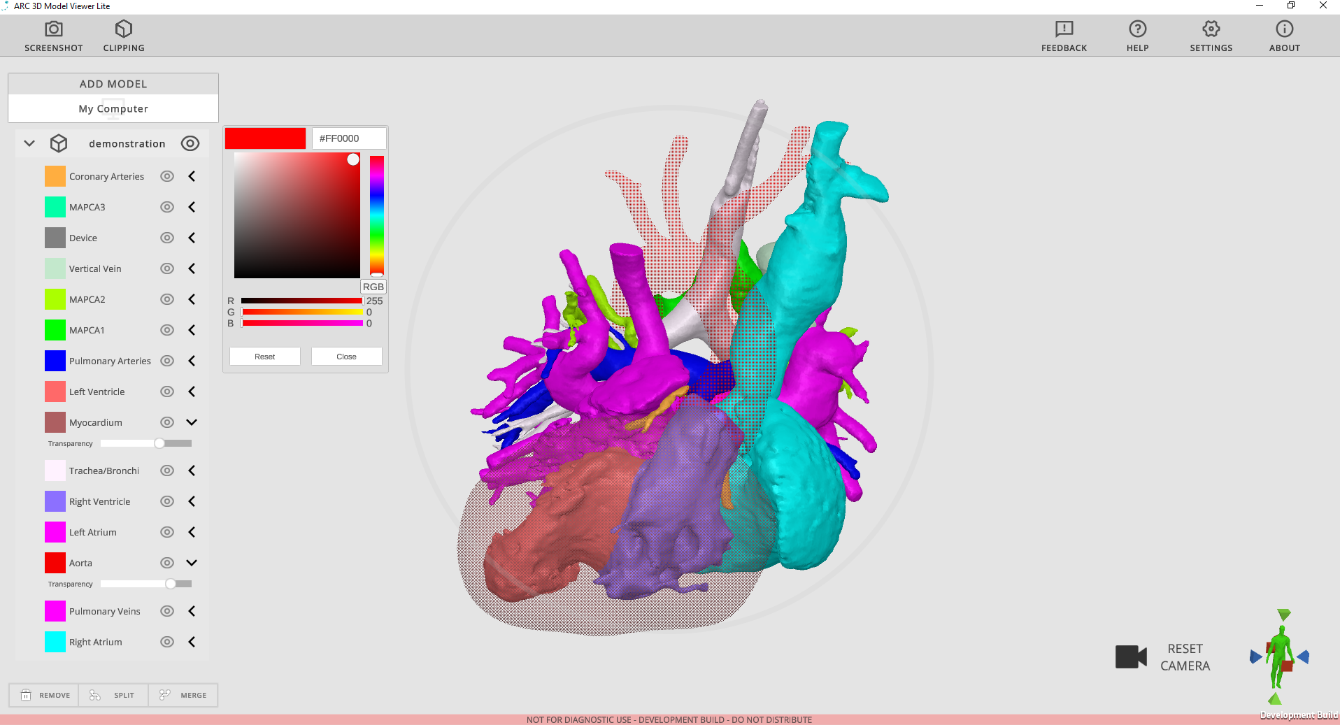 Rady Children's Hospital is making its Arc Viewer, a 3D modeling software developed by the 3D Innovations Lab within the hospital, available to use by other U.S. hospitals at no cost.