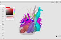 Rady Children's Hospital is making its Arc Viewer, a 3D modeling software developed by the 3D Innovations Lab within the hospital, available to use by other U.S. hospitals at no cost.