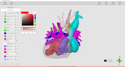 Rady Children's Hospital is making its Arc Viewer, a 3D modeling software developed by the 3D Innovations Lab within the hospital, available to use by other U.S. hospitals at no cost.