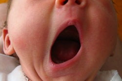 Baby Yawn