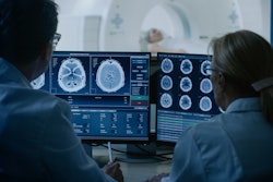 Brain Mri