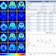 C-11 carfentanil PET brain images in the sagittal plane (left column) and multiple transaxial planes (2nd through 4th columns) are shown on the left side. Red arrows indicate brain stem (1st column), amygdala (2nd column), and ventral tegmentum (3rd column). Experimental group descriptions are shown on the right (top) along with Logan distribution volume ratio (DVR) volumes of interest (VOI) means and coefficient of variances (CV) with percent change compared with the healthy control (HC) mean (%Diff). P-values (Mann-Whitney U test) are also provided. The VOI DVRs are plotted in the bottom right graph.