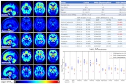 C-11 carfentanil PET brain images in the sagittal plane (left column) and multiple transaxial planes (2nd through 4th columns) are shown on the left side. Red arrows indicate brain stem (1st column), amygdala (2nd column), and ventral tegmentum (3rd column). Experimental group descriptions are shown on the right (top) along with Logan distribution volume ratio (DVR) volumes of interest (VOI) means and coefficient of variances (CV) with percent change compared with the healthy control (HC) mean (%Diff). P-values (Mann-Whitney U test) are also provided. The VOI DVRs are plotted in the bottom right graph.