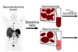 2024 07 11 Sa Rs Patients Lu 177 Dotatate Voter