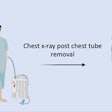 2024 07 29 Jtcvs Open Cxr Value Post Chest Tube Removal Matei Thumbnail